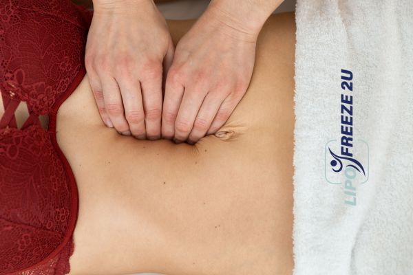 diastasis recti treatment Farnborough