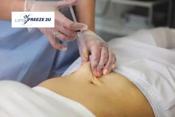 Fat Dissolving Injections Farnborough & Weight loss medication