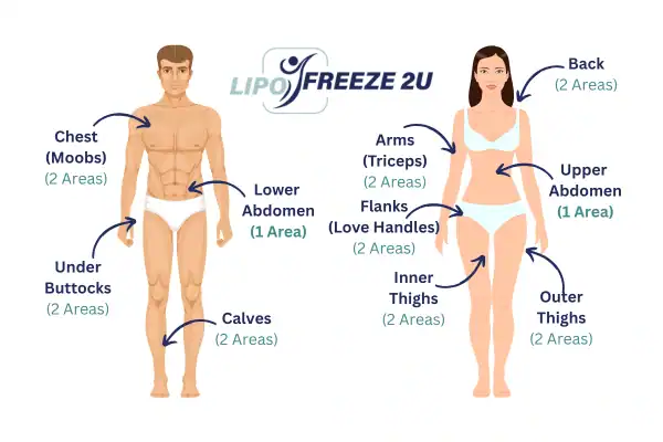 Areas you can have fat freezing treatment Farnborough