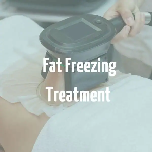 fat freezing treatment Farnborough