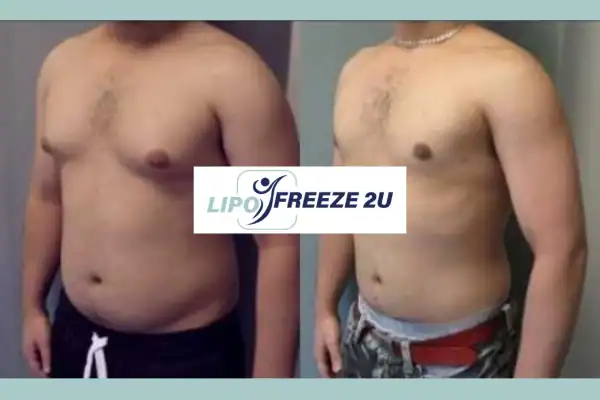 How Long Does It Take to See Results Farnborough?