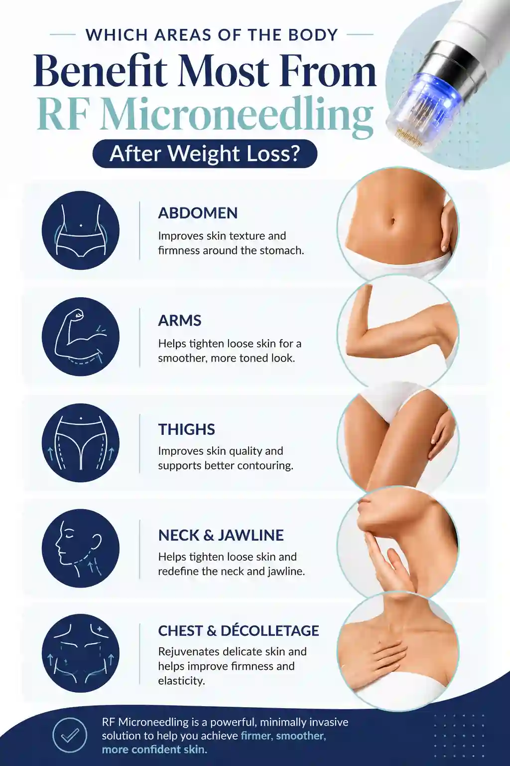 Which Areas of the Body Benefit Most From RF Microneedling After Weight Loss Farnborough